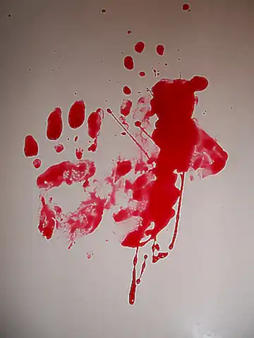 Die Bedeutung der forensischen Medizin im 21. Jahrhundert