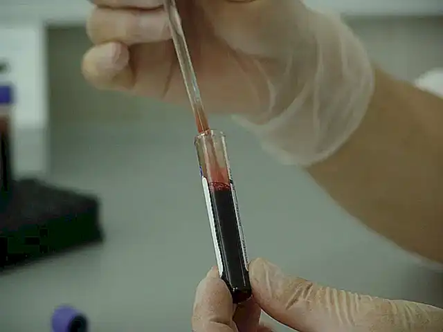 Lynettes Diagnose und ihre anfängliche Reaktion