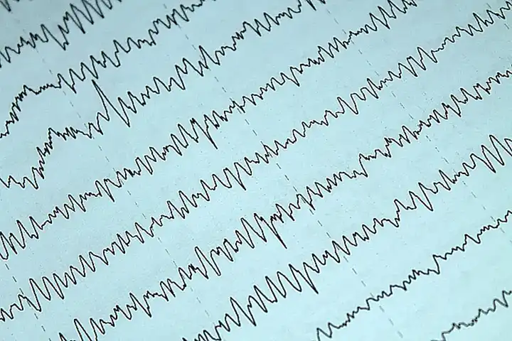 Technologischer Fortschritt und Brandprävention